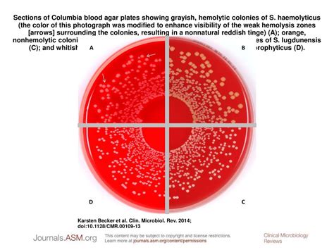 Blood Agar Plates and Hemolysis .